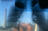 CiTyBreath