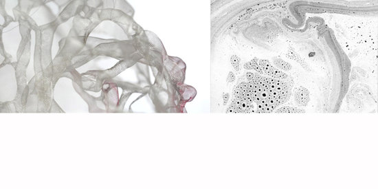 RESIDENCE DE CREATION A L'Hôpital d'Alençon - 2015 - photos macro et vue au microscope - 30 dessins 21/22 cm (eau, encre et pigments) - volumes en toile d'inox - installation exterieure de 80 m2