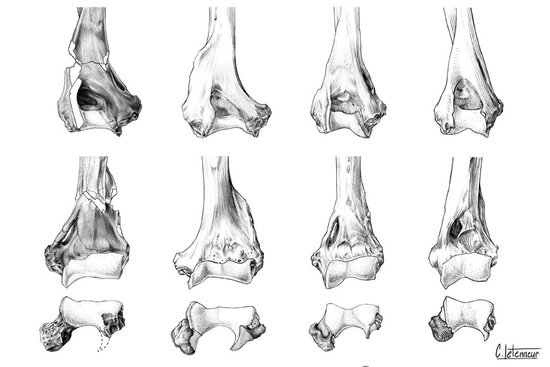 Anatomie comparée - Humérus partie distale